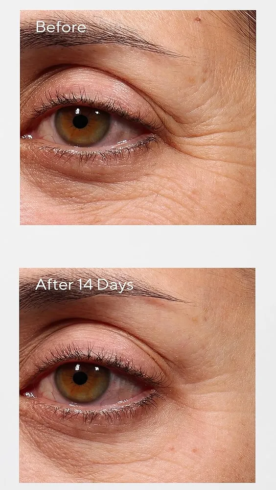 Murad   Retinol Youth Renewal Eye Serum 